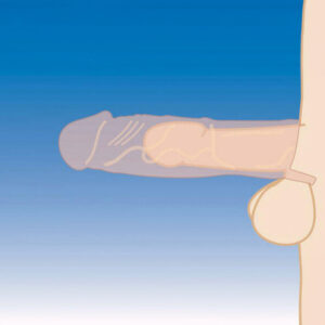 14593-cock-xtender-penis-extender-sleeve-natural-330534-limassol-love-shop